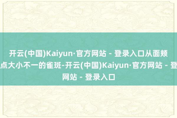 开云(中国)Kaiyun·官方网站 - 登录入口从面颊中心散点大小不一的雀斑-开云(中国)Kaiyun·官方网站 - 登录入口